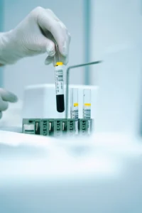 $99 TRT Club Bloodwork & Telemedicine Consult