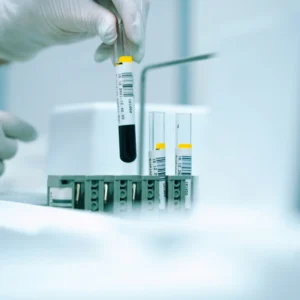 A gloved hand holds a test tube of blood above a rack containing other labeled test tubes in a laboratory setting.